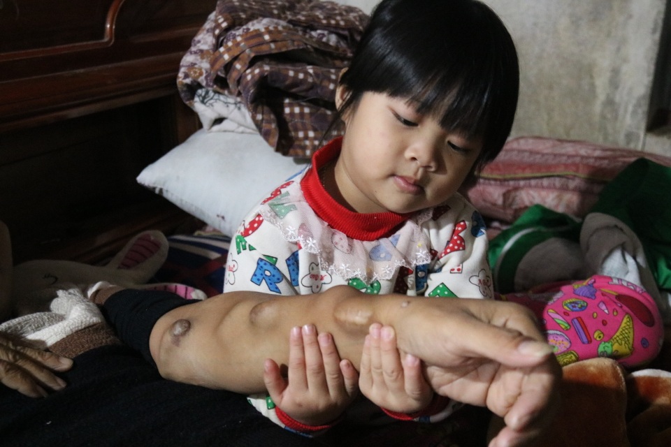 Người cha trẻ khát khao sự sống được bạn đọc giúp đỡ gần 170 triệu đồng - 1 Người cha trẻ khát khao sự sống được bạn đọc giúp đỡ gần 170 triệu đồng - 1