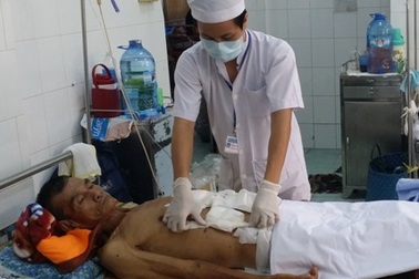 Cứu sống bệnh nhân bị phình động mạch chủ bụng có mạch, huyết áp bằng không