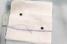 2 viên bi nam châm hút nhau xuyên thành ruột bé trai