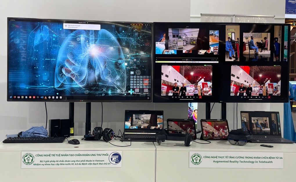 Mắt thần AI vượt qua bài kiểm tra với bác sĩ phát hiện sớm ung thư phổi - 1