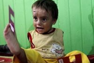 Cậu bé không tay tại Peru