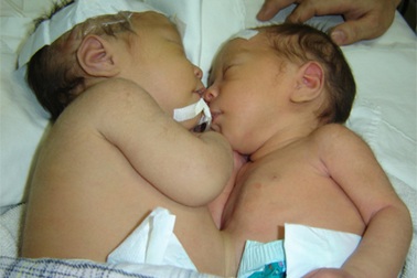 Chất lượng dân số Việt Nam vẫn ở mức thấp