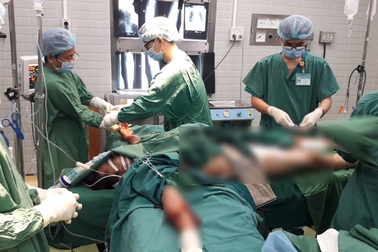 Cây cổ thụ bật gốc đè người đi đường chấn thương sọ não, gãy nát xương