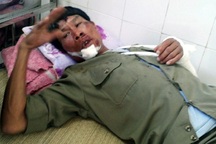 Hà Nội: Đi bắt kẻ trộm chó, một bảo vệ bị đâm gãy tay