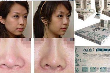 Sự thật về "thần dược" serum nâng mũi cho sóng mũi dọc dừa