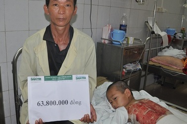 Gần 64 triệu đồng đến với bé dân tộc Dao bị bỏng cồn