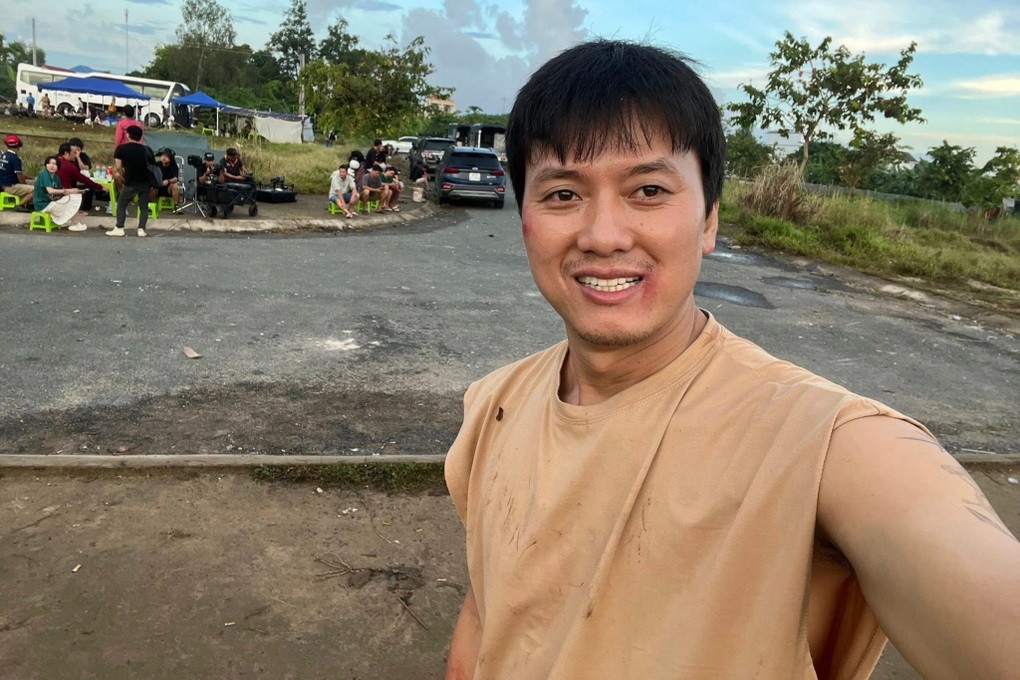 Quách Ngọc Tuyên gặp tai nạn giao thông, sức khỏe hiện ra sao? - 2 Quách Ngọc Tuyên gặp tai nạn giao thông, sức khỏe hiện ra sao? - 2