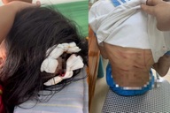 Dấu hiệu các tội danh vụ cha dượng bạo hành bé gái bằng búa đinh ở Hà Tĩnh