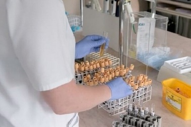 Phát hiện mới trong điều trị ung thư liên quan đến protein ERK5