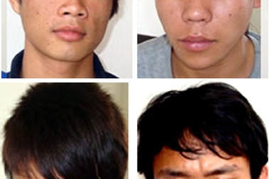 Bắt nhóm chuyên dùng taxi đi trộm chó