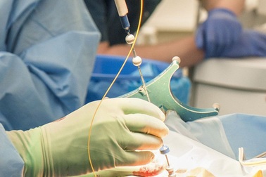 Phẫu thuật não sẽ ít rủi ro hơn nhờ công nghệ “kim thông minh” mới