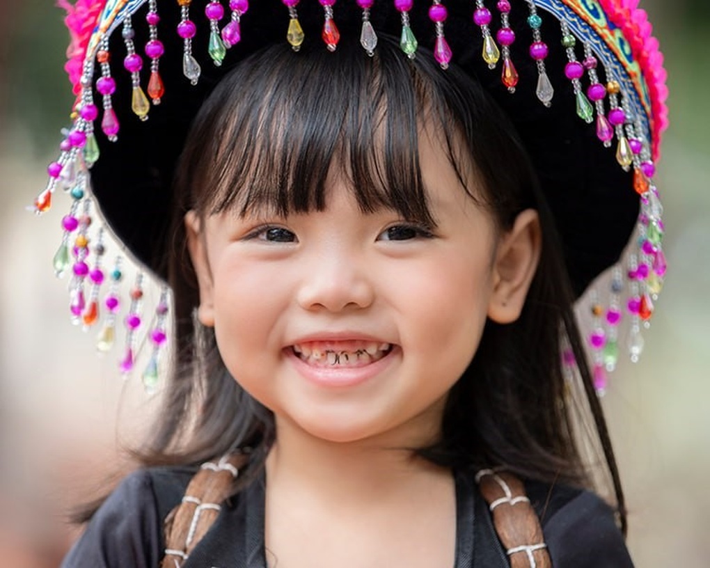 Mảng bám - thủ phạm gây sâu răng sữa ở trẻ - 1 Mảng bám - thủ phạm gây sâu răng sữa ở trẻ - 1