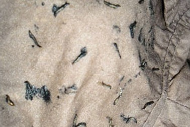 “Sinh vật lạ” trong bộ quần áo là ấu trùng ruồi giả ong