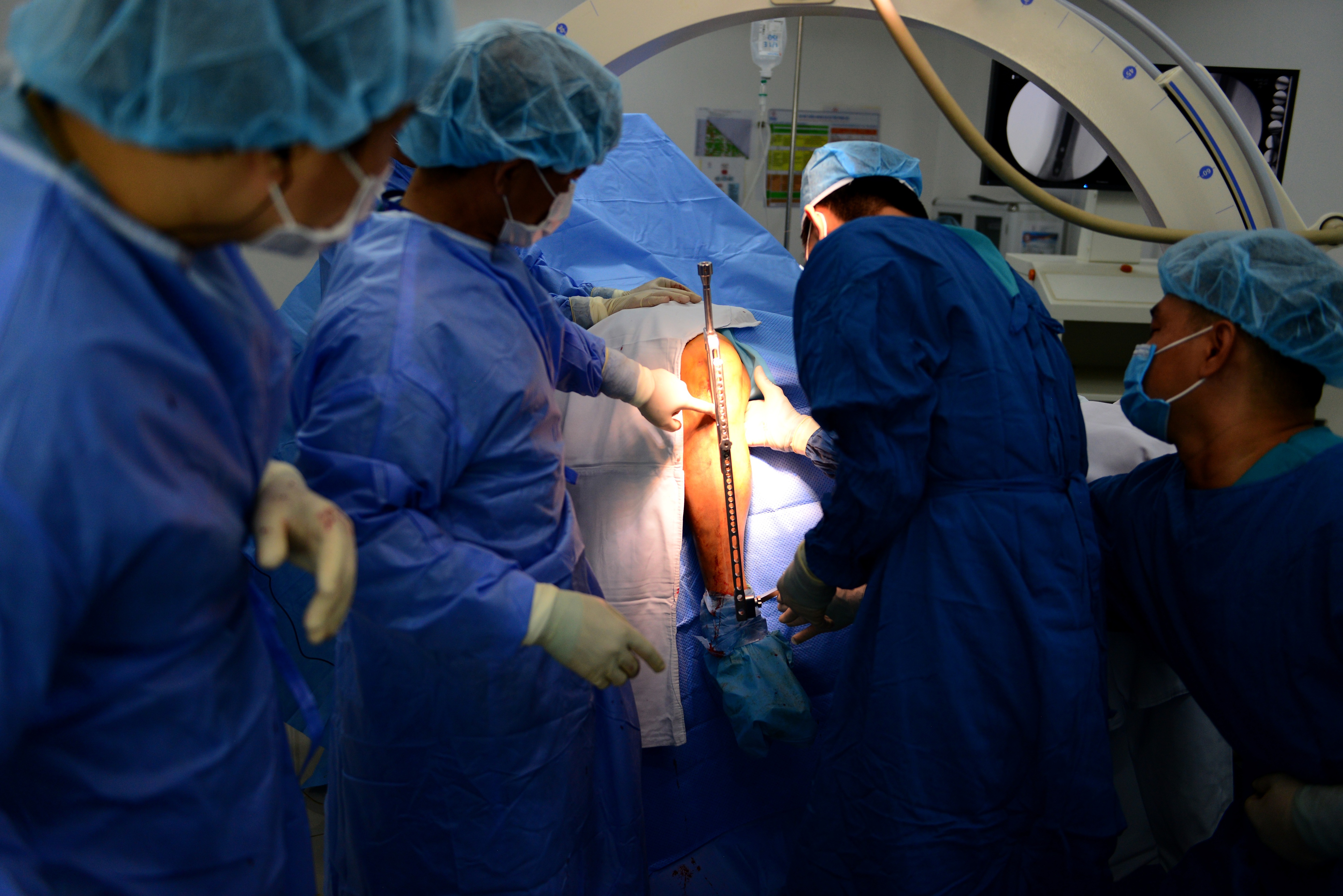 Phim chụp X-Quang lan truyền trên mạng xã hội không phải của Hùng Dũng - 1