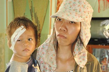 Bé 19 tháng tuổi bị mẹ ngược đãi