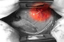 Mâu thuẫn trong đêm, nam thanh niên bị đâm thủng tim