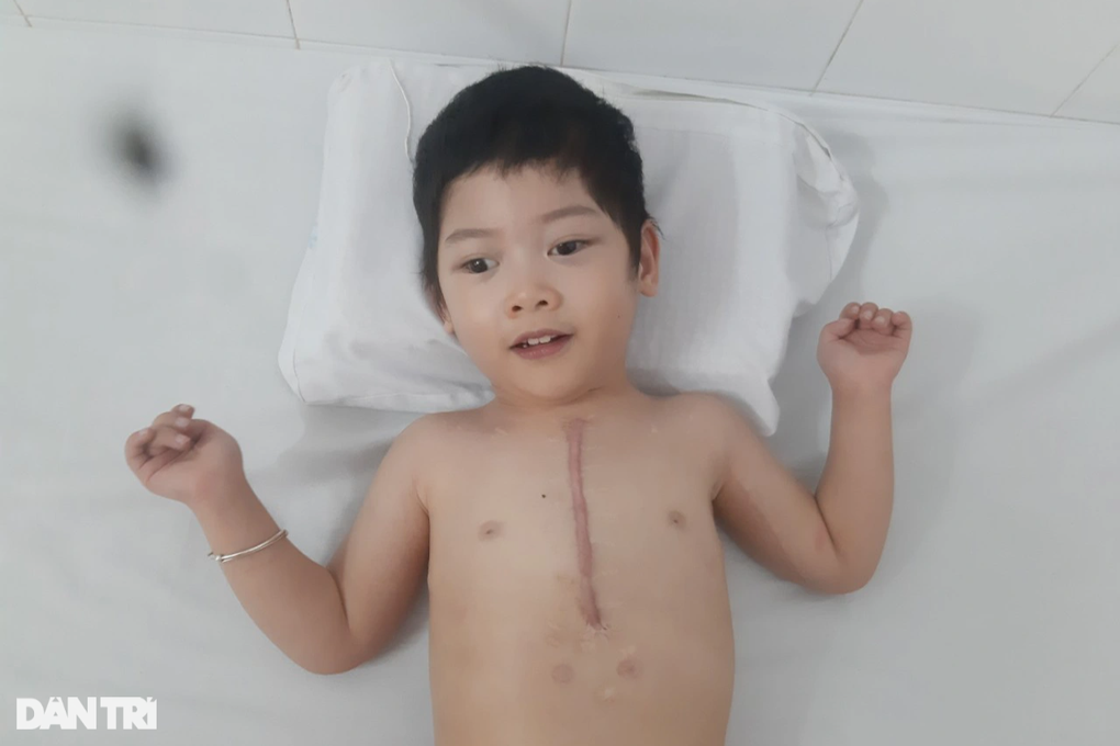 Xót xa tiếng khóc xé lòng của bé gái 4 tuổi bị bệnh tim và bại não hành hạ - 3 Xót xa tiếng khóc xé lòng của bé gái 4 tuổi bị bệnh tim và bại não hành hạ - 3