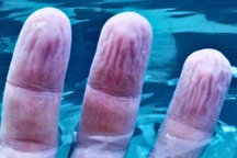 Đã tìm ra lời giải cho câu hỏi "vì sao ngón tay nhăn nếu ngâm nước lâu?"