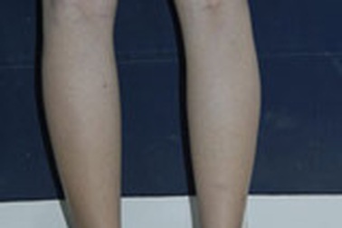 Chuyện đàn ông đi phẫu thuật thẩm mỹ