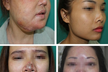 “Trùng tu” nhan sắc - những chuyện đau lòng