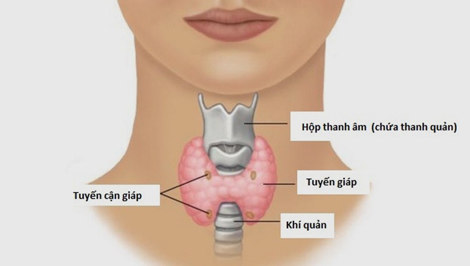 Ung thư tuyến giáp có điều trị dứt điểm được không? - 1 Ung thư tuyến giáp có điều trị dứt điểm được không? - 1