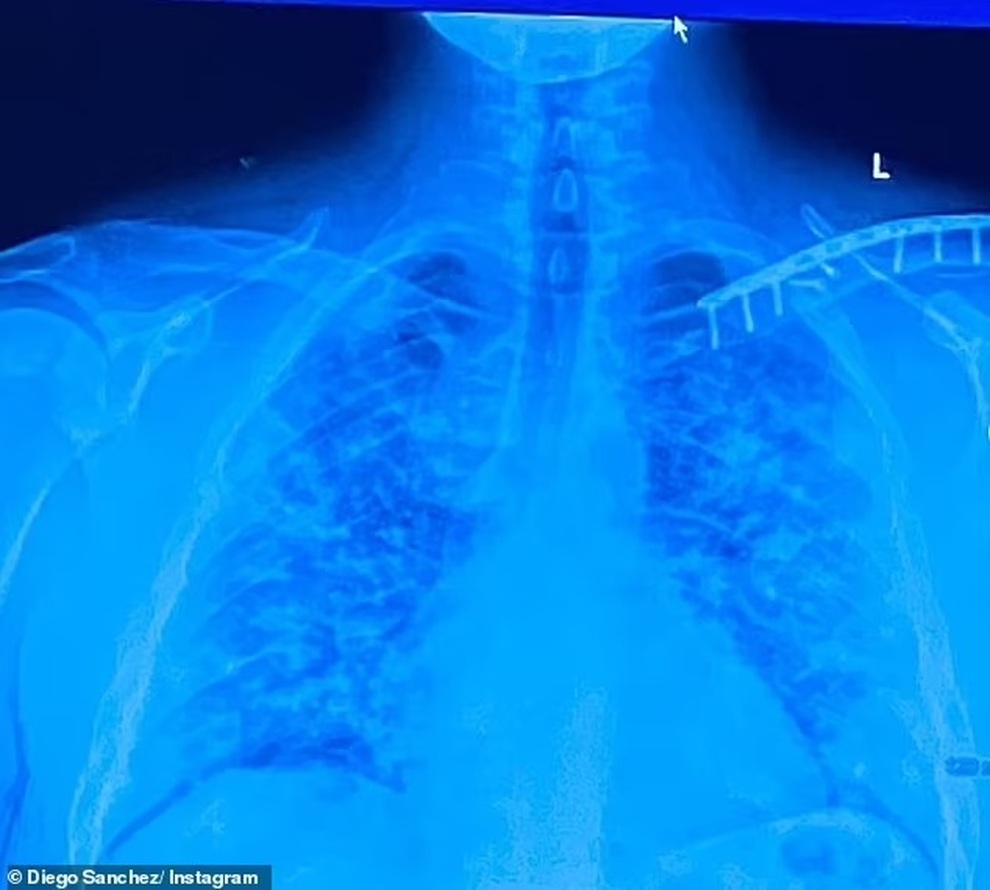 Huyền thoại UFC Diego Sanchez hối hận vì không tiêm vaccine phòng Covid-19 - 2