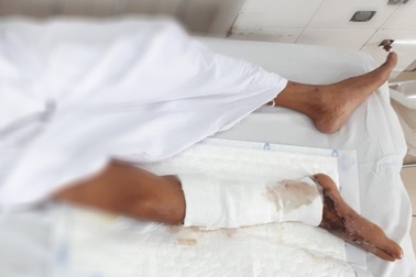 Ăn gỏi cá rô phi, người đàn ông suýt mất mạng vì nhiễm độc "tả biển"