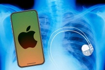 iPhone và nhiều thiết bị Apple có thể gây vấn đề nghiêm trọng về sức khỏe