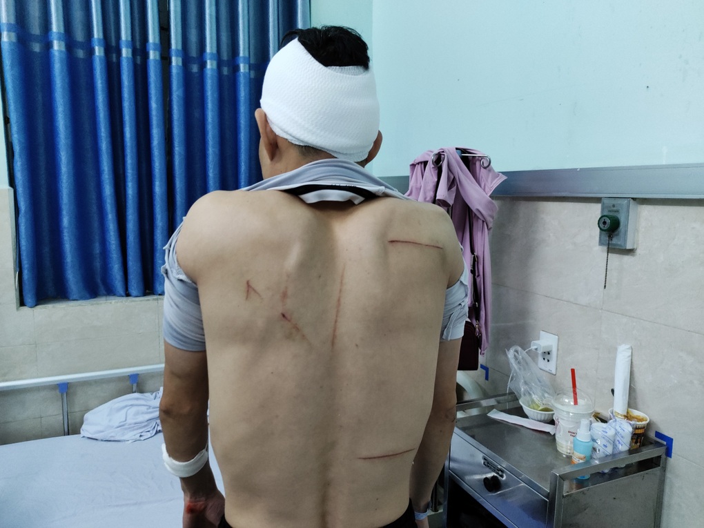 Điều tra nhóm côn đồ truy sát người dân ngay trong bệnh viện - 1 Điều tra nhóm côn đồ truy sát người dân ngay trong bệnh viện - 1