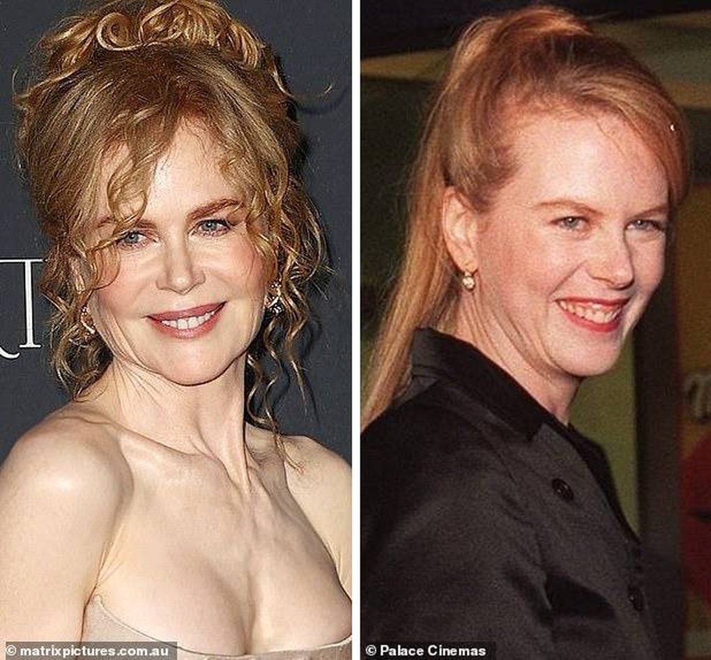 56 tuổi, Nicole Kidman vẫn xứng danh thiên nga Australia - 2