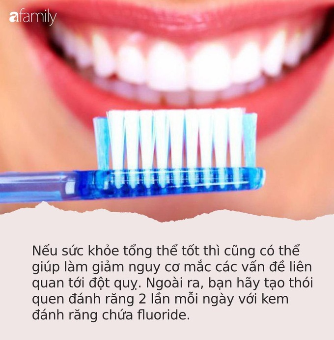 Cảnh báo: Những người bị chảy máu nướu răng có nguy cơ đột quỵ não cao gấp 2 lần - Ảnh 3. Cảnh báo: Những người bị chảy máu nướu răng có nguy cơ đột quỵ não cao gấp 2 lần - Ảnh 3.