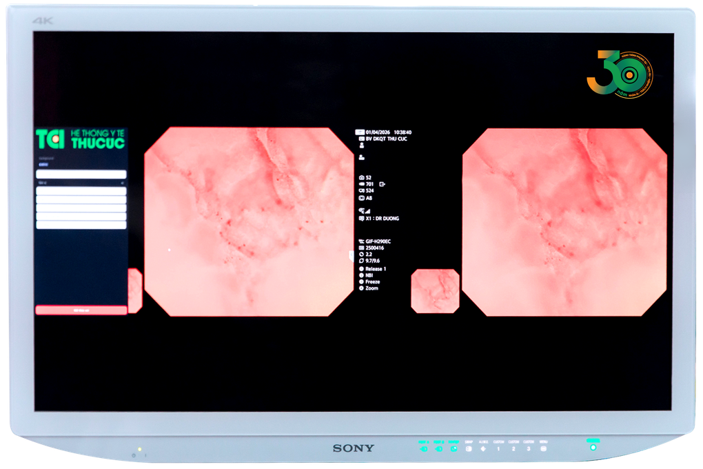 Endocyto 520x: Vai trò trong chẩn đoán và định hướng phát triển nội soi tiêu hóa - 3
