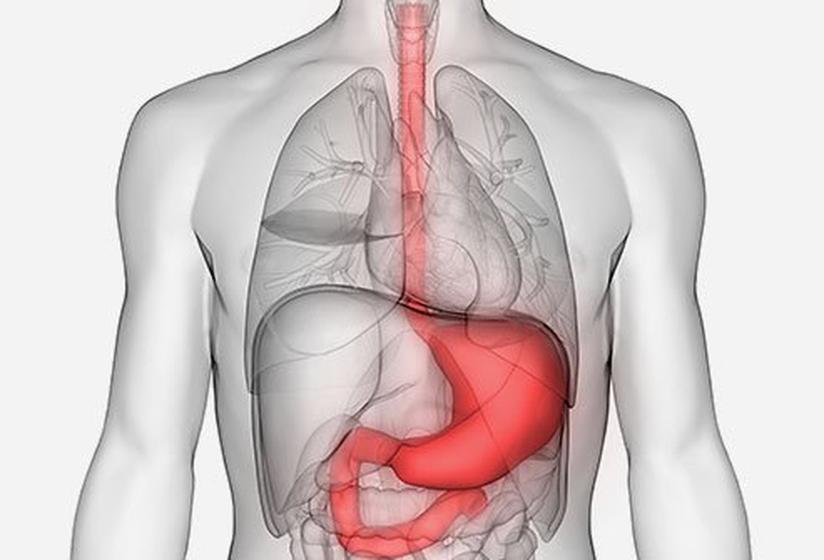 Dễ nhầm lẫn các triệu chứng của ung thư dạ dày và viêm loét dạ dày - 1 Dễ nhầm lẫn các triệu chứng của ung thư dạ dày và viêm loét dạ dày - 1