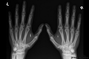 Cấy chip siêu nhỏ vào cơ thể nhân viên để... công việc dễ dàng hơn