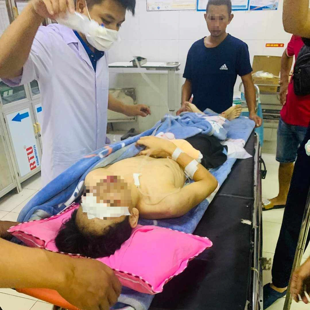 Nam sinh dập nát tay, tổn thương mắt sau tiếng nổ lớn - 1 Nam sinh dập nát tay, tổn thương mắt sau tiếng nổ lớn - 1