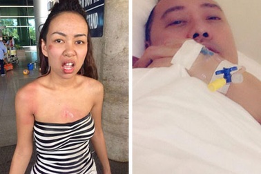 Thực hư nghệ sĩ bị cướp