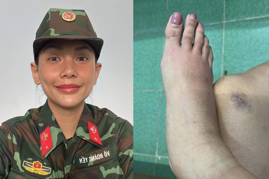 Siêu mẫu Võ Hoàng Yến bị thoái hóa khớp tuổi 35, việc catwalk ra sao? - 1 Siêu mẫu Võ Hoàng Yến bị thoái hóa khớp tuổi 35, việc catwalk ra sao? - 1