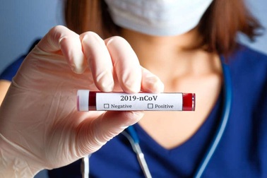 Điều gì sẽ xảy ra khi một người bị nhiễm đồng thời hai biến thể SARS-CoV-2?