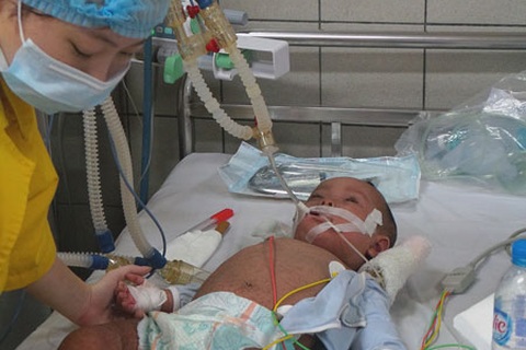 Thêm hai trường hợp tử vong do sởi trong ngày 1/5 