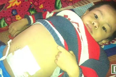 Cậu bé 8 tuổi mắc chứng bệnh thận cận kề cái chết.