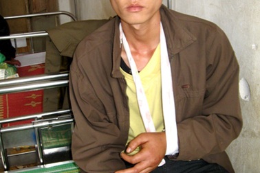 Khỉ độc lại liên tục tấn công người