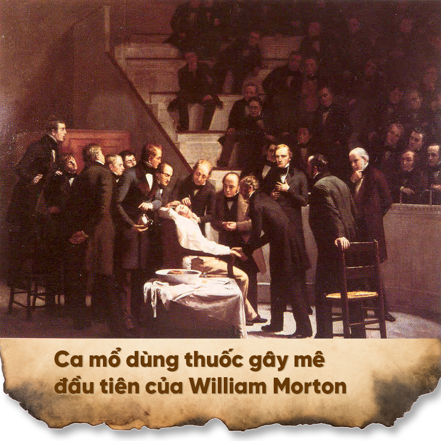 Trước khi có thuốc gây mê, những ca mổ diễn ra như thế nào? - 1 Trước khi có thuốc gây mê, những ca mổ diễn ra như thế nào? - 1
