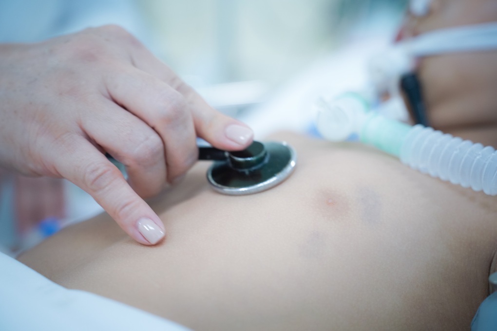 Bé trai bị cành cây rơi giữa đường làm nứt sọ, Thứ trưởng chỉ đạo đặc biệt - 2 Bé trai bị cành cây rơi giữa đường làm nứt sọ, Thứ trưởng chỉ đạo đặc biệt - 2