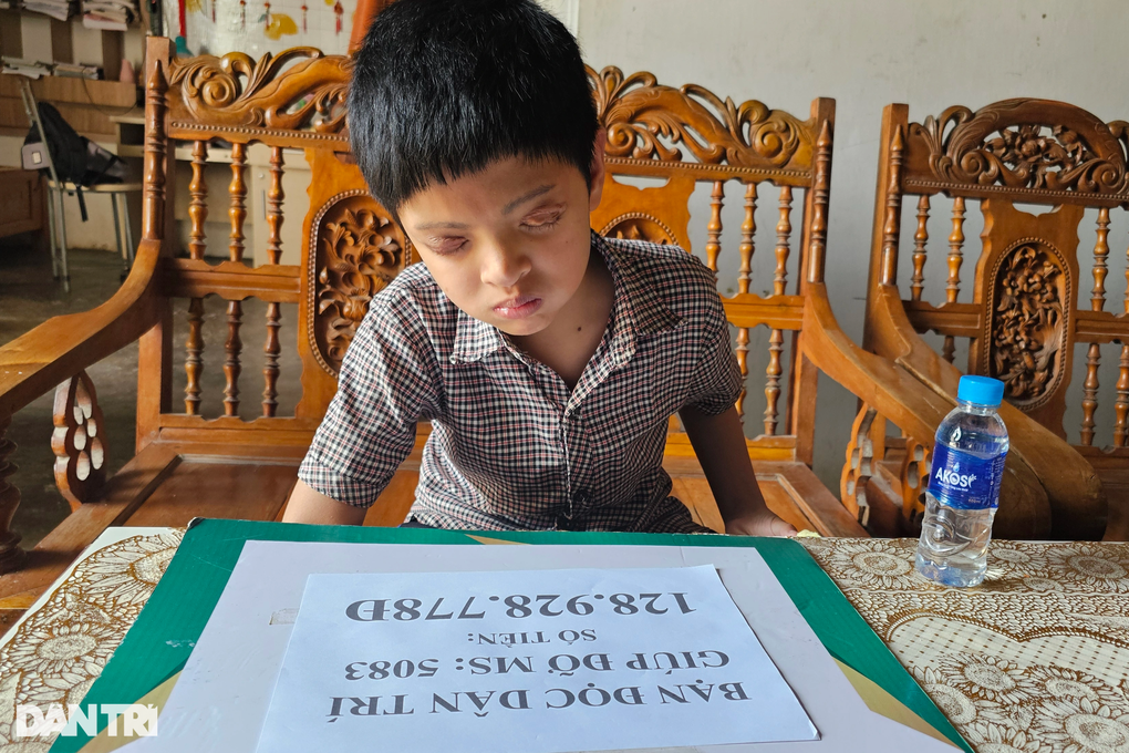 Nhờ độc giả Dân trí, con trai tôi có thêm cơ hội cứu chữa đôi mắt - 2 Nhờ độc giả Dân trí, con trai tôi có thêm cơ hội cứu chữa đôi mắt - 2