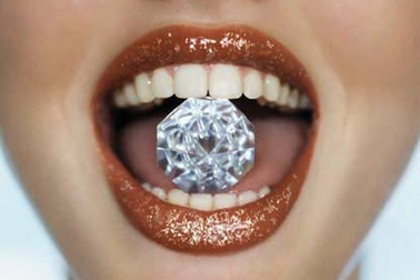 5 lưu ý khi tẩy trắng răng