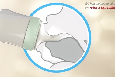 Đồ họa mô phỏng cơ chế bú mẹ và bú với núm ty  dẹt chỉnh nha.