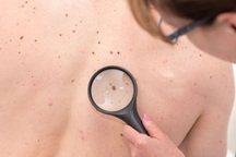 Đề xuất bảo hiểm y tế chi trả khám sàng lọc ung thư