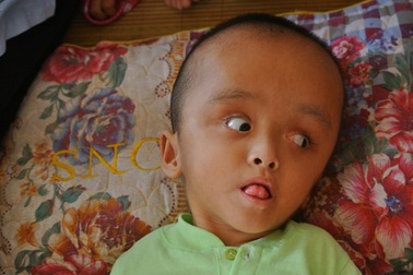 Xót xa bé gái 3 tuổi mắc bệnh não úng thủy nằm chờ chết ở nhà tình thương