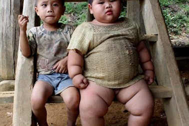 Lý giải nguyên nhân béo phì bé trai 2 tuổi khổng lồ