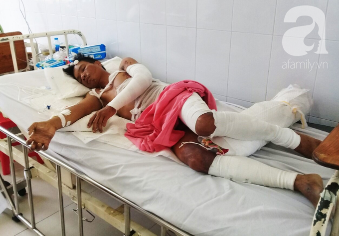 Vừa chịu tang mẹ chồng, người vợ đau đớn khi chồng lại bị điện giật bỏng nặng trong lúc làm thuê nuôi 2 con nhỏ - Ảnh 1. Vừa chịu tang mẹ chồng, người vợ đau đớn khi chồng lại bị điện giật bỏng nặng trong lúc làm thuê nuôi 2 con nhỏ - Ảnh 1.
